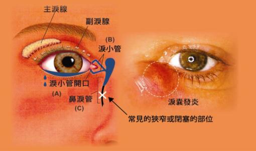 眼眶病