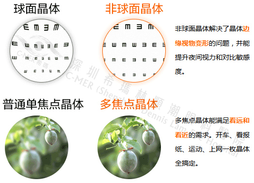 白內障