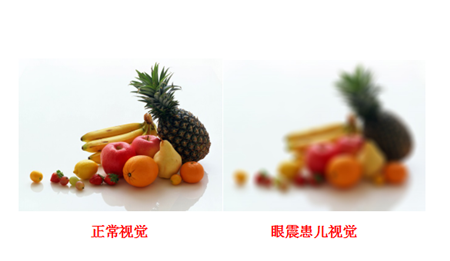 小兒眼病