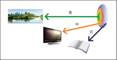屈光矯視