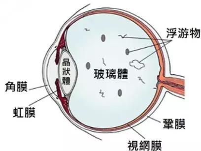 玻璃體視網膜