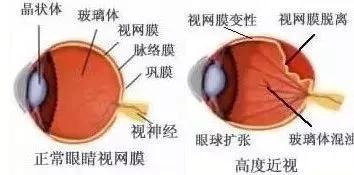 玻璃體視網膜