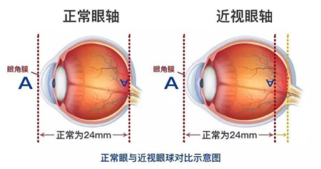 玻璃體視網膜