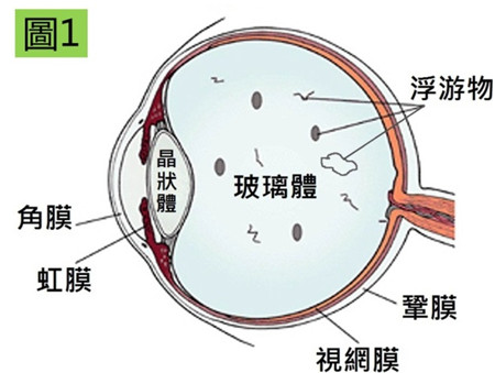 玻璃體視網膜