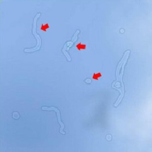 玻璃體視網(wǎng)膜