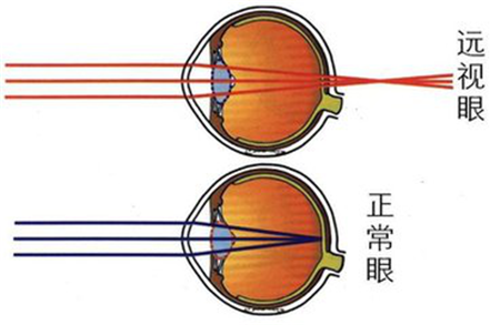 小兒眼病