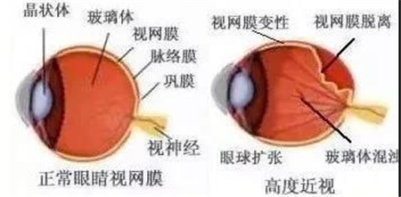 玻璃體視網膜