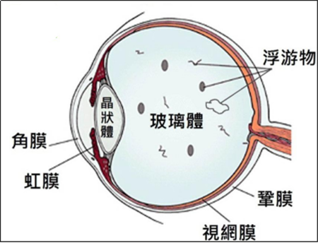 玻璃體視網膜