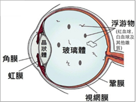 玻璃體視網膜