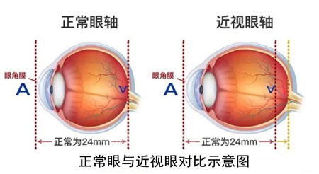玻璃體視網(wǎng)膜