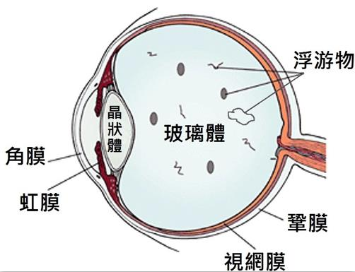 玻璃體視網膜