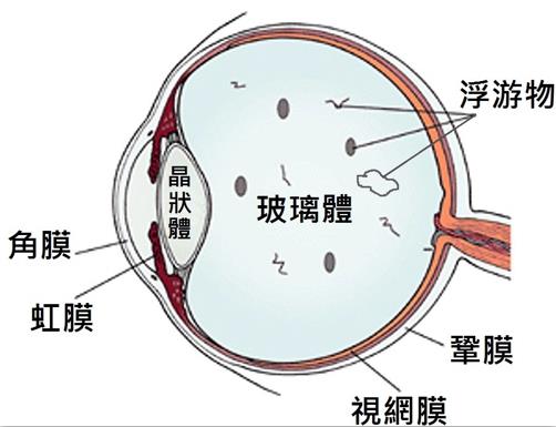 玻璃體視網(wǎng)膜